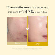 Medicube Kojic Acid Turmeric Brightening Night Wrapping Mask with Vitamin C, Retinol & Collagen – 75ml