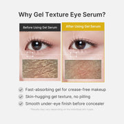 Medicube Kojic Acid Turmeric Vita Brightening Eye Gel Serum with Vitamin C & Caffeine – 30ml