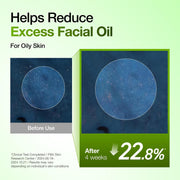 Anua Gentle Skin Serum with Azelaic Acid and Hyaluronic Acid - 30ml