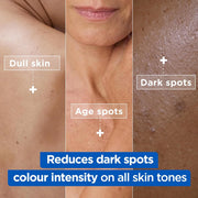 Mixa Niacinamide Bright Anti-Dark Spot Moisturizing Cream for Face, Body & Hands - 400ml